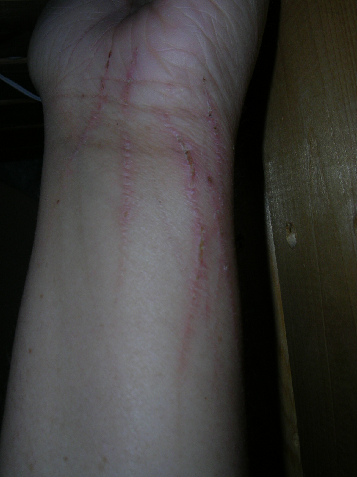 One week after